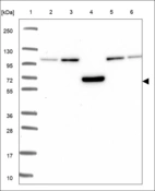 Anti-TEKT5 Antibody
