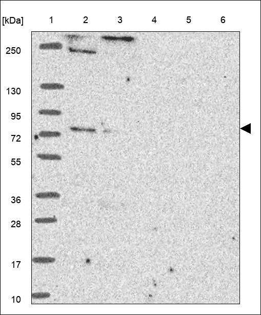 Anti-SCNN1G Antibody