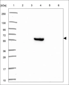 Anti-SLC6A14 Antibody
