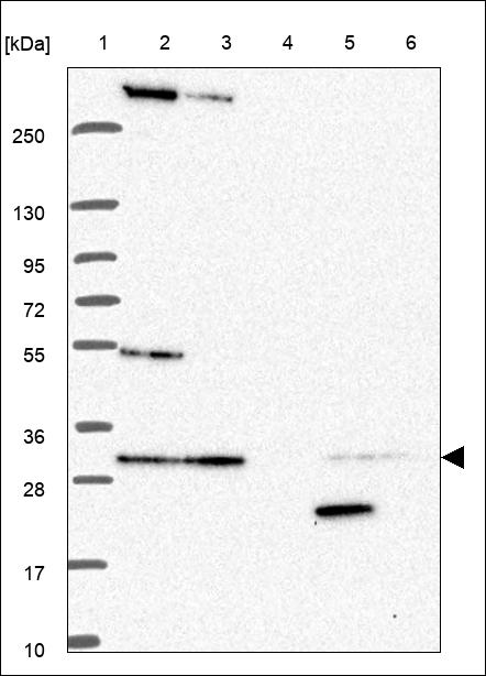Anti-NSMCE1 Antibody