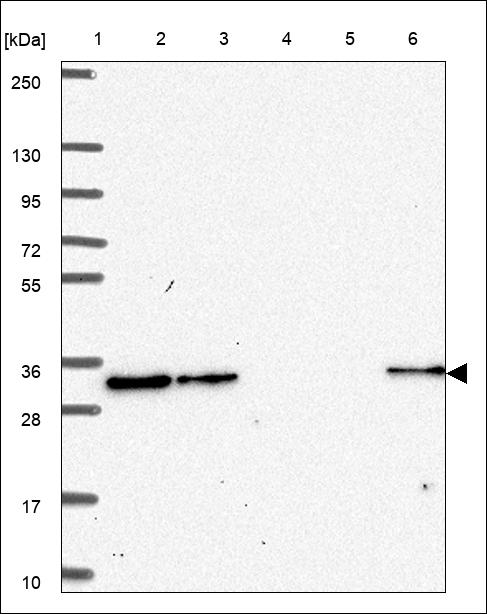 Anti-HOXD9 Antibody