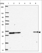 Anti-HOXD9 Antibody