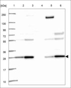 Anti-HDDC2 Antibody