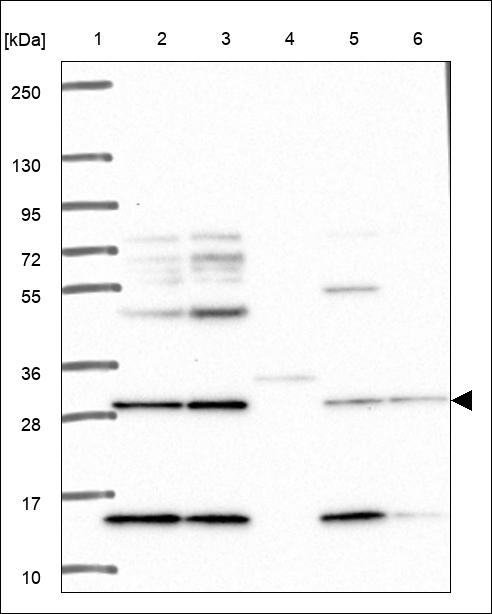 Anti-ZFAND3 Antibody