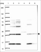 Anti-ZFAND3 Antibody