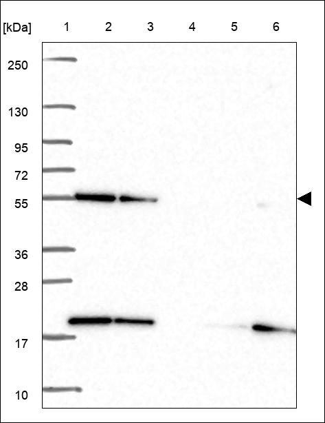 Anti-HARS1 Antibody