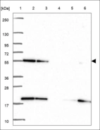 Anti-HARS1 Antibody