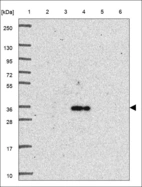 Anti-ZNHIT2 Antibody