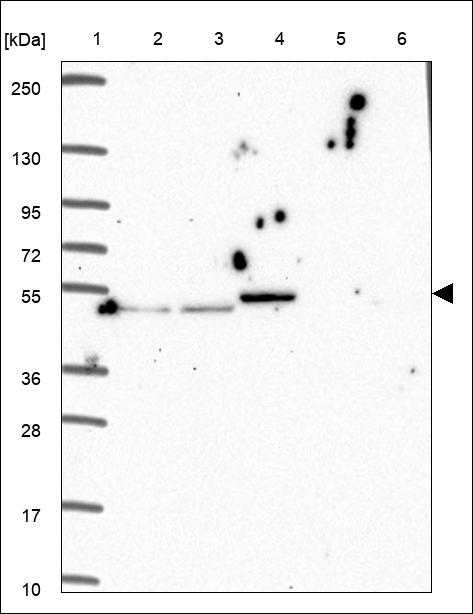 Anti-DUS1L Antibody