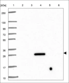 Anti-TNFAIP8L3 Antibody