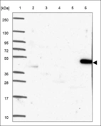 Anti-TMEM39A Antibody