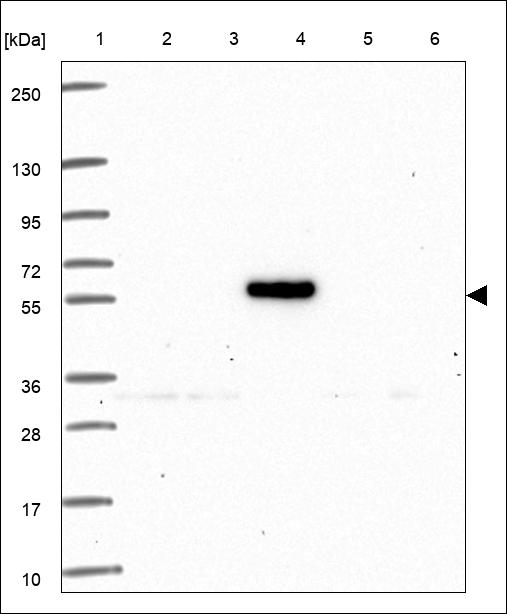 Anti-EFEMP1 Antibody