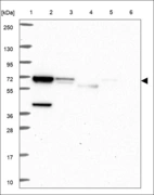Anti-BMPR1A Antibody