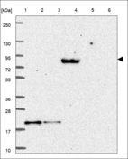 Anti-RSPH6A Antibody