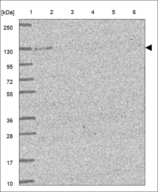 Anti-DAB2IP Antibody