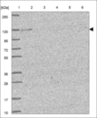 Anti-DAB2IP Antibody