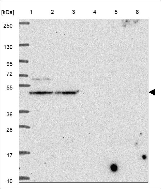 Anti-PIGG Antibody