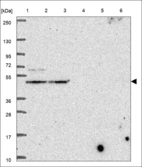 Anti-PIGG Antibody