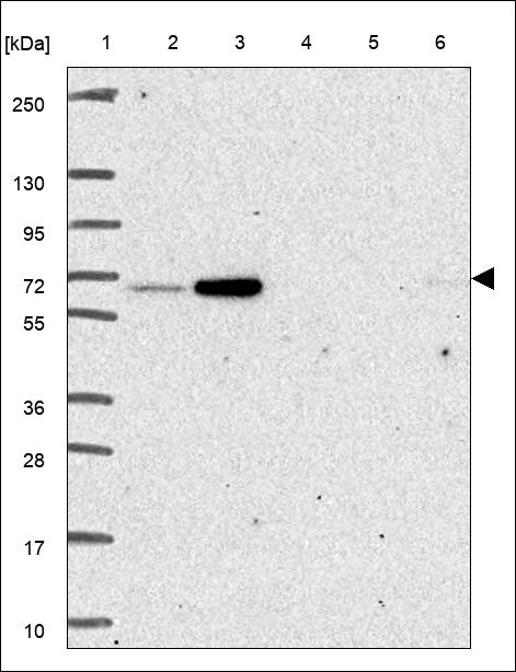 Anti-ZNF227 Antibody