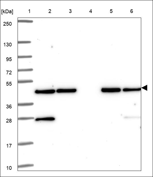 Anti-PGK1 Antibody