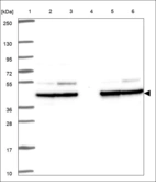 Anti-PGK1 Antibody