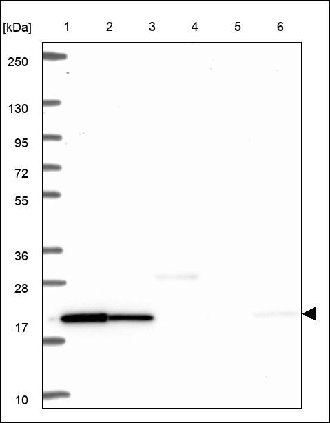 Anti-EMC4 Antibody