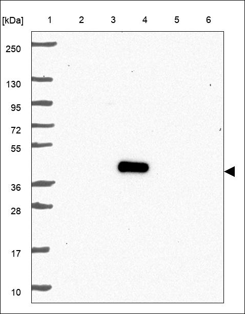 Anti-SLC39A7 Antibody