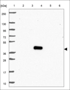 Anti-SLC39A7 Antibody