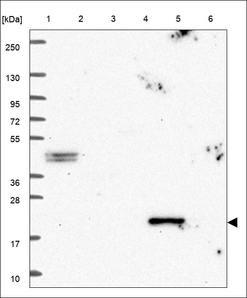 Anti-FAM180A Antibody