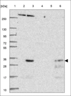 Anti-RBM38 Antibody