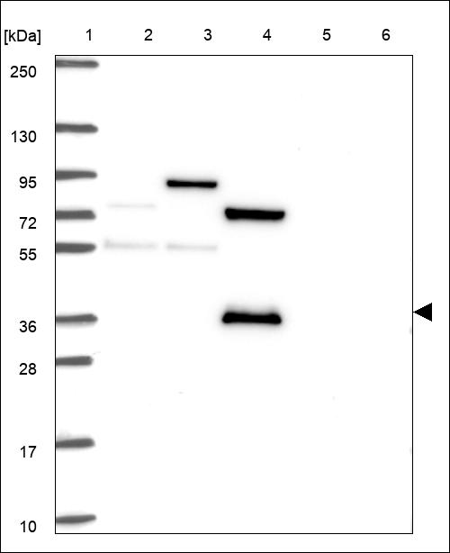 Anti-KCNAB3 Antibody