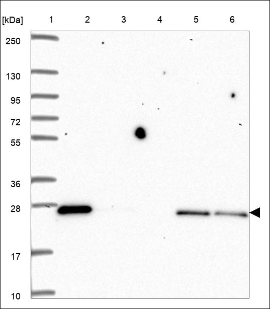 Anti-LYPLA2 Antibody
