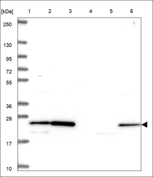 Anti-CENPN Antibody