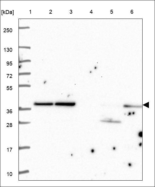 Anti-AP3M2 Antibody