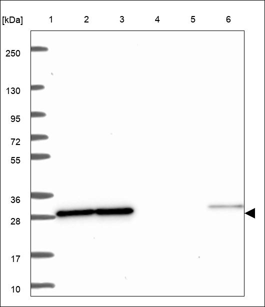 Anti-RAN Antibody