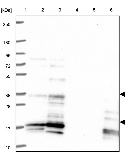 Anti-PLPP5 Antibody