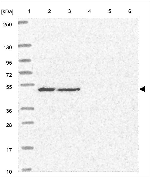 Anti-STK26 Antibody