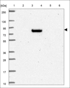 Anti-ABCB7 Antibody