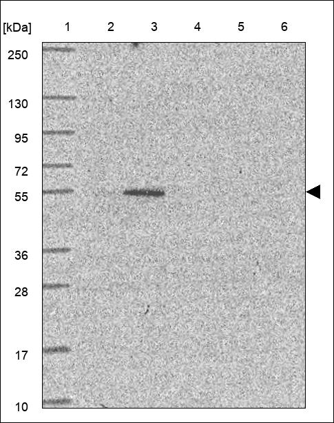 Anti-ZFP69B Antibody