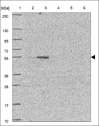 Anti-ZFP69B Antibody