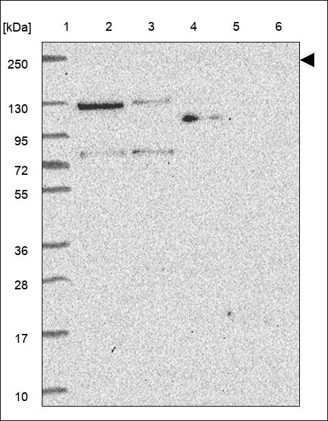 Anti-VIRMA Antibody