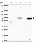 Anti-CORO1C Antibody