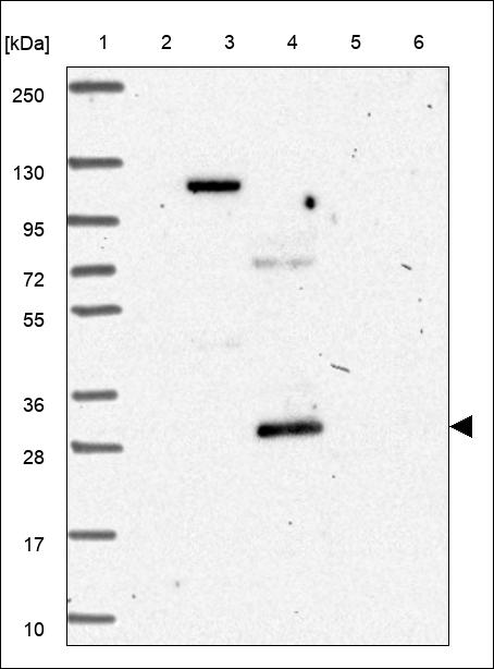 Anti-MS4A18 Antibody
