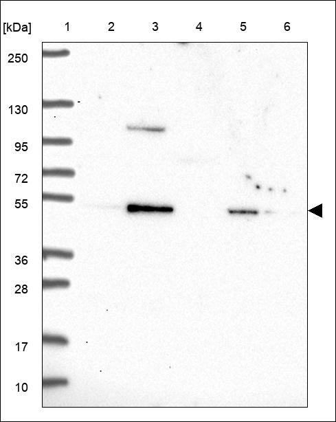Anti-SLC1A4 Antibody