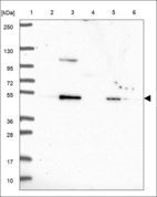 Anti-SLC1A4 Antibody