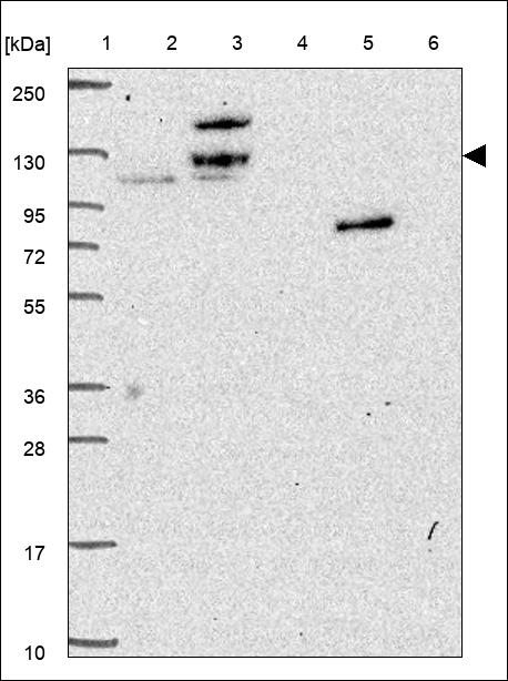 Anti-RFC1 Antibody