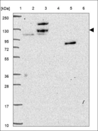 Anti-RFC1 Antibody