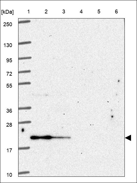Anti-TGIF2 Antibody
