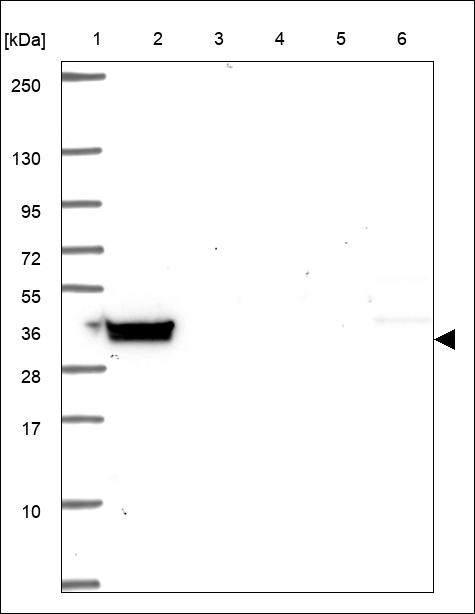 Anti-PLAGL1 Antibody