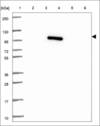 Anti-NUTM2A Antibody